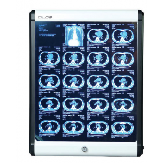 ĐÈN XEM PHIM X-Quang - KHAY CHỨA PHIM